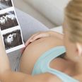 Pregnant women are using two things to figure out the sex of their baby early