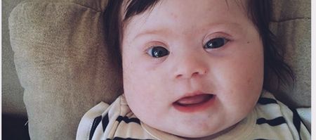 ‘It’s not what she IS, it’s what she HAS.’ – Mum’s post on Down Syndrome goes viral