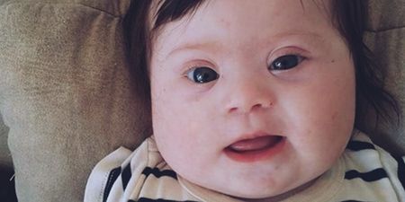 ‘It’s not what she IS, it’s what she HAS.’ – Mum’s post on Down Syndrome goes viral