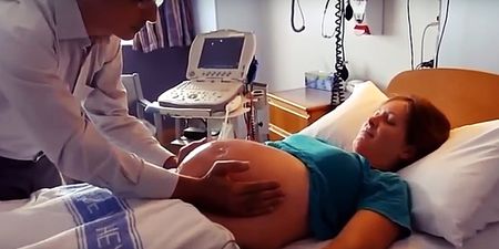 WATCH: The Moment A Breech Baby Is Turned Around