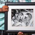 Intimate before-and-after photos of premature babies