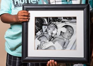Intimate before-and-after photos of premature babies