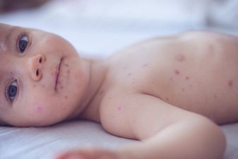 Researchers examine why ‘anti-vaxxers’ decide against immunising