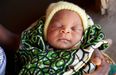 Photographer captures powerful photos of Malawi’s brave mums