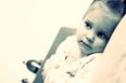 Slapped Cheek Syndrome: What To Look Out For