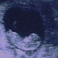 This ultrasound is going viral (for a freaky reason)