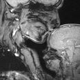 This Mama /Baby MRI Scan Shows The Fragility Of Human Life
