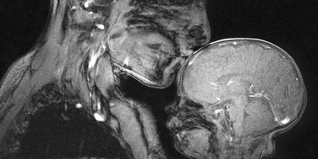 This Mama /Baby MRI Scan Shows The Fragility Of Human Life