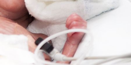 Conjoined Twins ‘Unlikely To Survive’