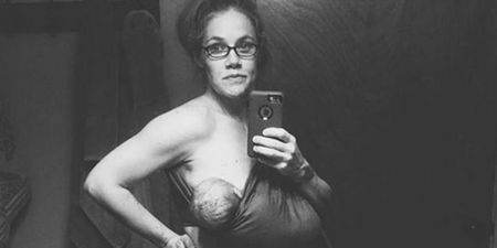 Mother-of-Four Praised for Postpartum Picture
