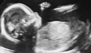 Hang On, Is Gwen Steffani Pregnant?