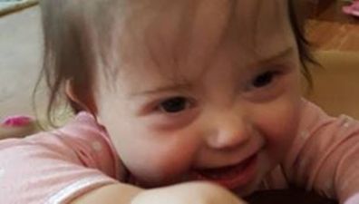 Woman Speaks Out About Daughter’s Down Syndrome Diagnosis In Moving Facebook Post