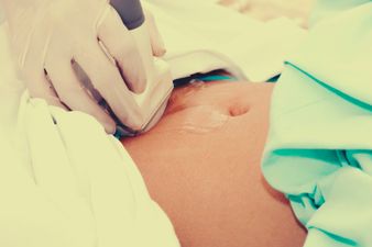 A Couple’s Ultrasound Snap Is Going Viral For a Very Quirky Reason