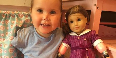 Toddler Who Lost Limbs To Meningitis Has Found A Doll ‘Just Like Me’