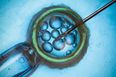 Cellfie Time: The Latest Trend In Baby Photos Starts At CONCEPTION