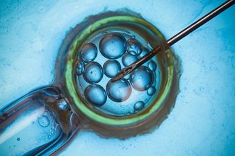 Cellfie Time: The Latest Trend In Baby Photos Starts At CONCEPTION