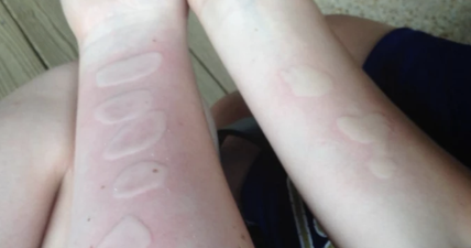 Parents Warned Over This Dangerous Ice And Salt Challenge That’s Sweeping The Internet