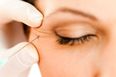 The botox edit – everything you need to know