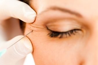 The botox edit – everything you need to know