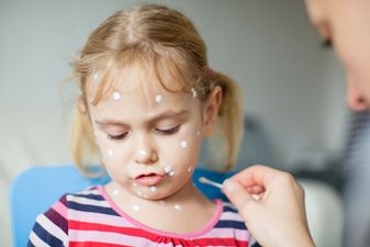 99 problems but an itch ain’t one? Now there’s a chicken pox park