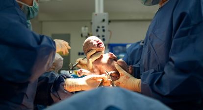 Doctors are choosing C-sections over fears of being sued