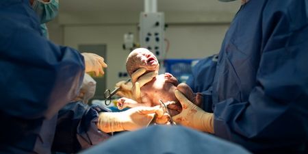 Doctors are choosing C-sections over fears of being sued