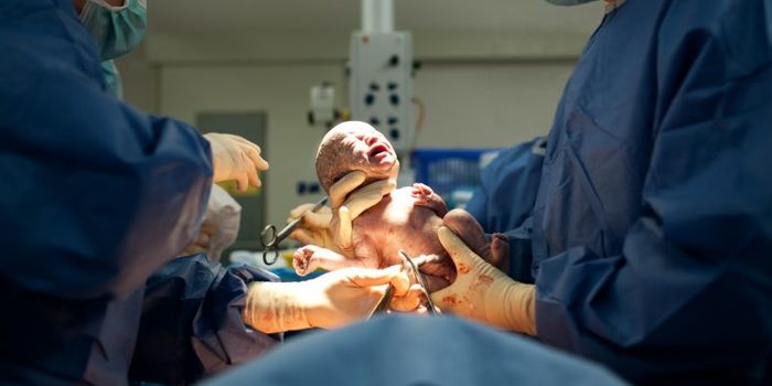 Doctors are choosing C-sections over fears of being sued