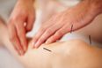 World’s largest trial finds acupuncture as effective as pain medicine