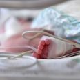 Breakthrough: Doctors identify ‘rogue’ baby epilepsy gene