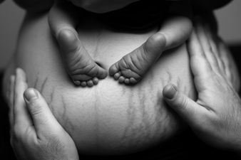 I’m not embarrassed of the scars’ Why every mum should read this message