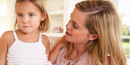 Everything parents need to know about measles as the outbreak continues