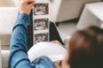 Researchers think they might have figured out what causes stillbirth