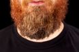 So, THIS is why some non-ginger men end up with ginger beards