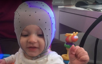 Baby born with ‘flattened’ head after mum was in labour for over a month
