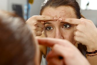 So here’s the reason behind breakouts on each part of your face