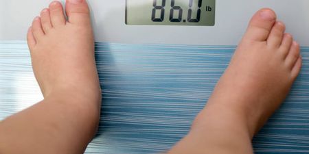 Obese children likely to die 20 years before healthy children