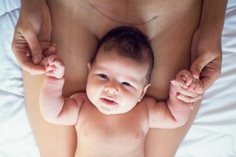 The effects of a C-section last much longer than you think, a new study has found