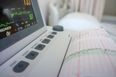 HSE to review foetal monitor safety issues at a number of Irish hospitals