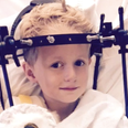 A little boy broke his neck but doctors missed it for 5 weeks