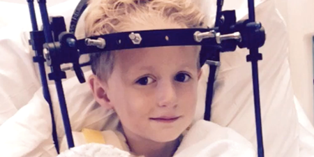 A little boy broke his neck but doctors missed it for 5 weeks