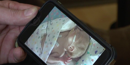 These cameras are making it easier for NICU parents to see their babies