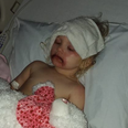 One toddler ended up in hospital covered in blisters after using kids makeup