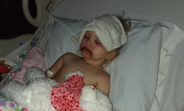 One toddler ended up in hospital covered in blisters after using kids makeup