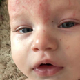 Mum says €8 body lotion ‘transformed’ her baby’s eczema