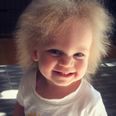 This adorable little girl has extremely rare hair and it’s absolutely amazing