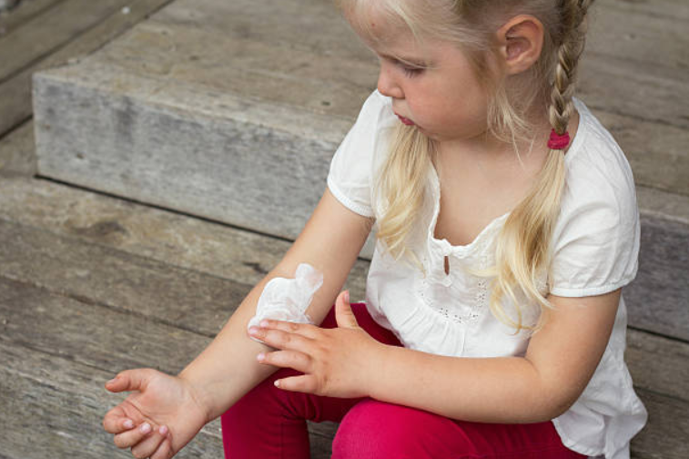 New study finds eczema affects 1 in 5 children in Ireland