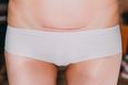 Viral video shows exactly what a person goes through when they have a c-section