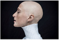 Stunning Irish model with alopecia covers magazine totally hair-free