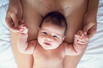 This mum has invented special underwear to help with C-section recovery
