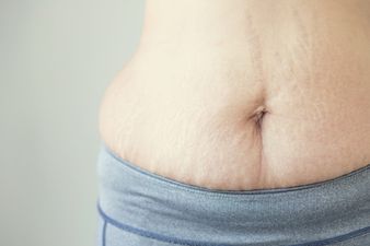 In a world of perfection here’s to the mums with stretch marks and mum tums